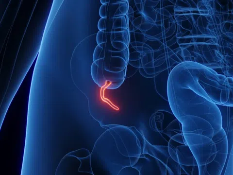 Một loại ung thư hiếm gặp đang gia tăng ở người trẻ tuổi