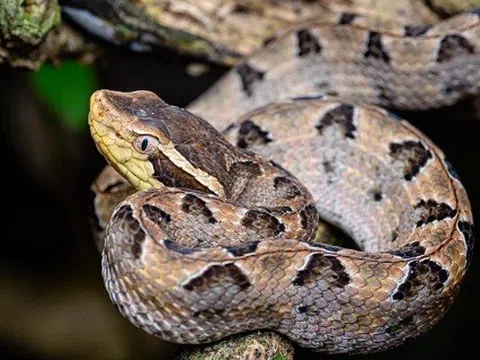 Tự đắp lá chữa rắn cắn, nam thanh niên bị nhiễm độc nặng