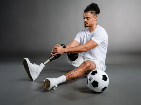 Cầu thủ phải cắt chân sau cơn sốt của bệnh do não mô cầu