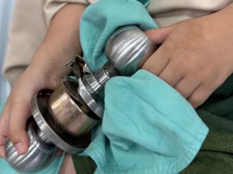 Bác sĩ TP.HCM thành 'thợ sửa ổ khóa' ngay trong phòng mổ