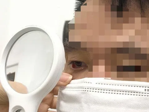 Ngứa vùng sinh dục dữ dội suốt 1 năm, kết quả soi da khiến bác sĩ sốc