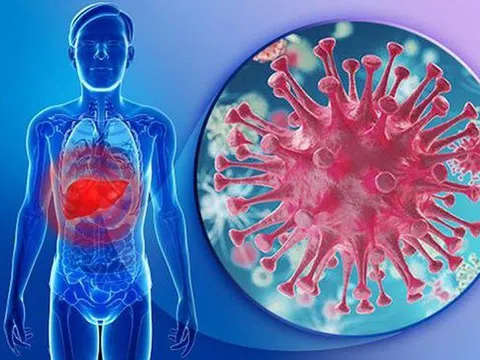Gánh hậu quả vì bỏ điều trị viêm gan B