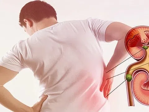 7 tác nhân âm thầm gây tổn thương thận không nên bỏ qua