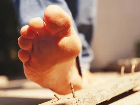 Gánh hậu quả đau lòng từ vết thương ai cũng chủ quan