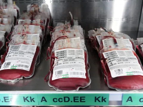 Nhóm máu liên quan đến nguy cơ mắc ung thư dạ dày