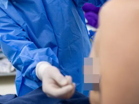 Người phụ nữ nhập viện với vùng ngực đầy mủ, biến dạng