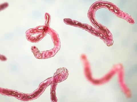 Người lớn bao lâu nên tẩy giun một lần?