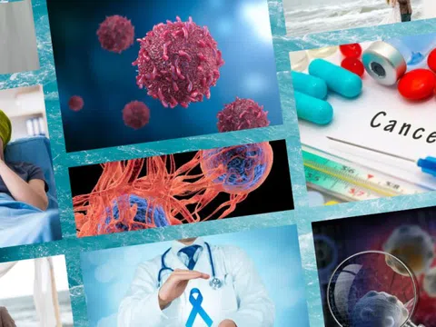 Thế giới đã sẵn sàng đối phó với làn sóng ung thư toàn cầu đang gia tăng?