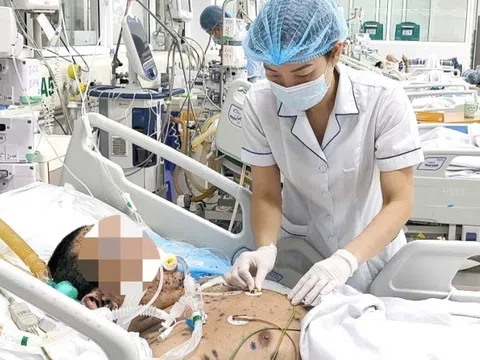 Lây thủy đậu từ con gái, người đàn ông 36 tuổi nhập viện nguy kịch