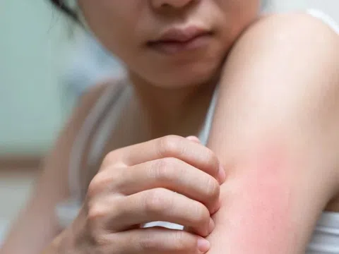 Dấu hiệu hệ tiêu hóa quá tải, cần thay đổi càng sớm càng tốt