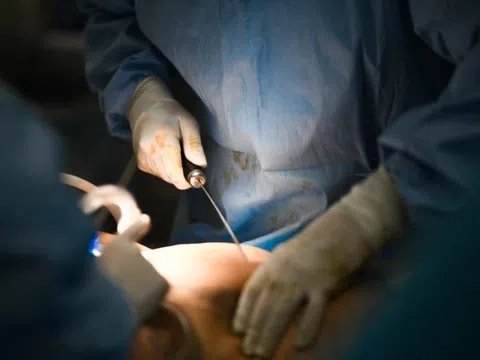 Tình trạng sốc của người phụ nữ sau khi hút mỡ suốt 7 tiếng tại spa