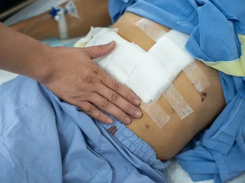 Một dấu hiệu cảnh báo sớm bệnh gan mật không nên bỏ qua