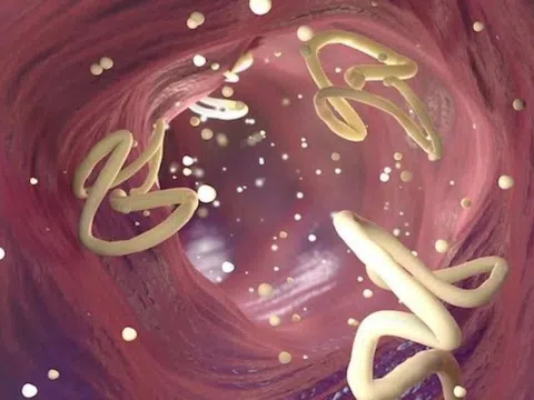 Vì sao cần tẩy giun định kỳ?