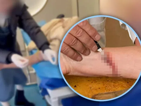 Trung Quốc triệt phá 'ổ nhóm' thầy thuốc dởm dùng liệu pháp chích máu 'giải tà khí'