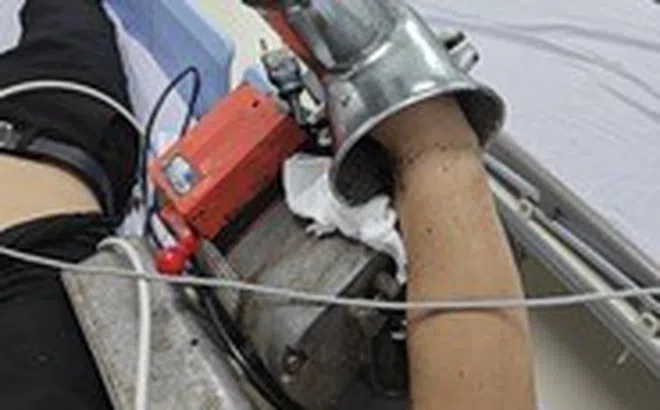 Vào viện với cánh tay lủng lẳng máy xay thịt