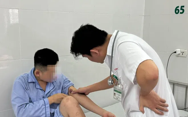 Giun sán ký sinh khắp cơ thể nam thanh niên 21 tuổi