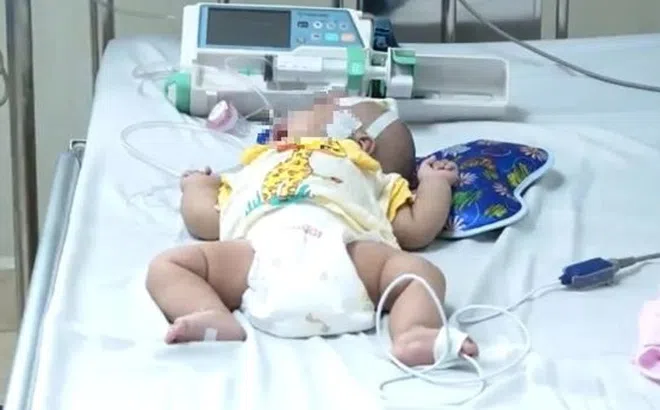 Cứu bé 1,5 tháng tuổi mắc ho gà, nhập viện đã ngưng thở