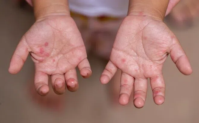 Đồng Nai tăng cường phòng chống dịch chủ động