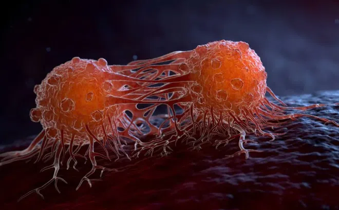 4 'thủ phạm' gây ung thư phổ biến nhất