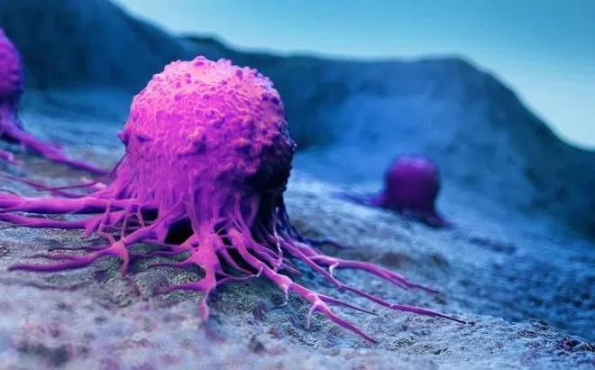 Nhóm người cần cảnh giác với ung thư đường tiêu hóa