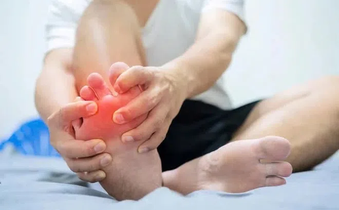 Dấu hiệu cơn đau cảnh báo bệnh gout bạn dễ bỏ qua