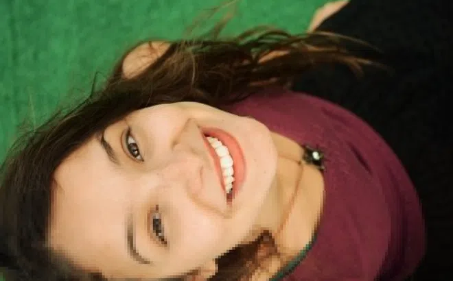 Răng xỉn màu làm cách nào để trắng sáng?