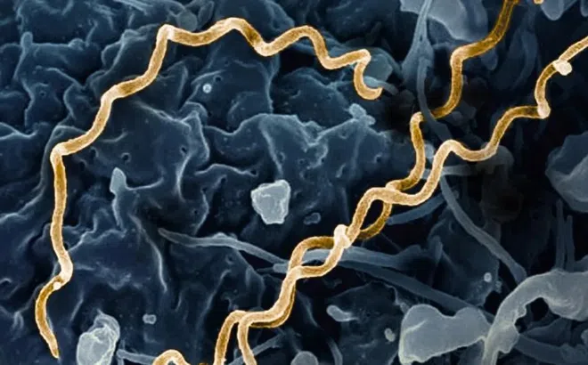 Bệnh giang mai đang ngày càng nguy hiểm hơn