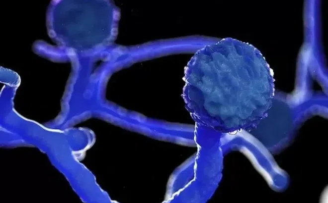 Đi khám suốt 3 tháng không ra bệnh vì mắc loại nấm nguy hiểm