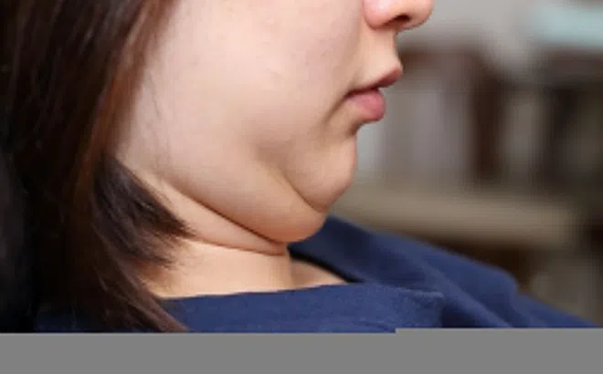 Những bộ phận càng to sức khỏe càng bất ổn