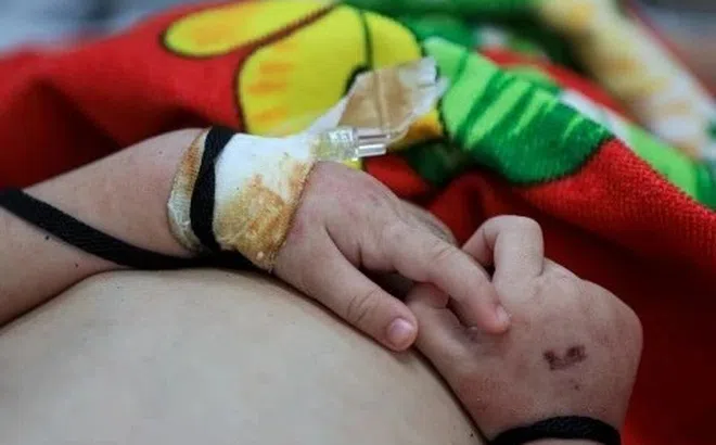 Ca sởi ở TP.HCM tiếp tục tăng, thêm 1 trẻ tử vong