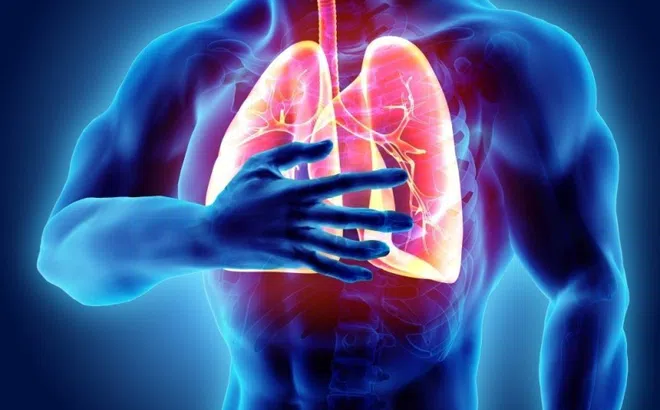 Sai lầm khiến bệnh phổi tắc nghẽn mạn tính trở nặng