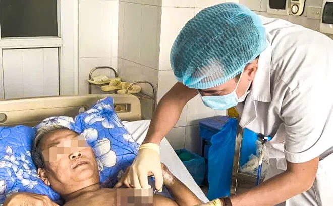 Cẩn trọng loại nấm nguy hiểm gây hoại tử mô, cơ hay gặp sau chấn thương