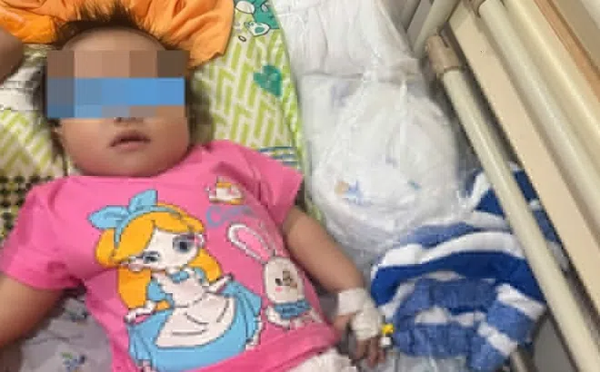 Liên tiếp trẻ ở TP.HCM nhập viện vì hóc dị vật