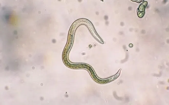 Dấu hiệu cảnh báo bị nhiễm giun đũa chó mèo