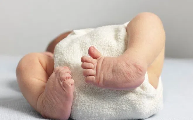 Câu hỏi thường gặp liên quan đến loạn sản sụn xương