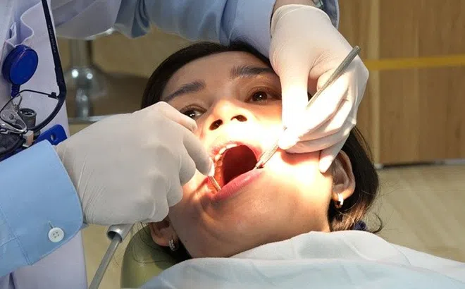Hạn chế cao răng tại nhà bằng cách ăn uống cực đơn giản