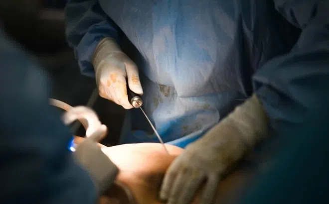 Tai biến thẩm mỹ tại Bệnh viện Đa khoa Gia Định