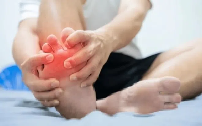 Các tác nhân phổ biến gây bệnh gout