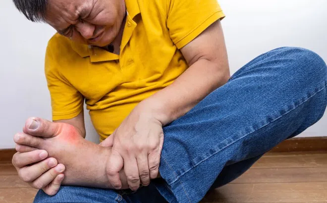 Người bị gout nên điều chỉnh ăn uống như thế nào?