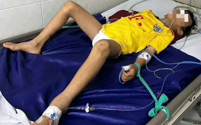 Bé trai nguy kịch vì vết thương nhỏ ở ngón chân
