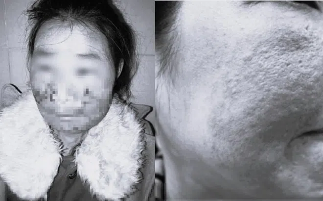 Mỹ phẩm nhà làm: Xanh lành hay 'xanh mặt'?