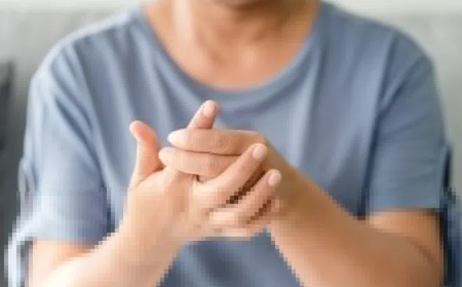 Nhận biết dấu hiệu bệnh gout ở bàn tay