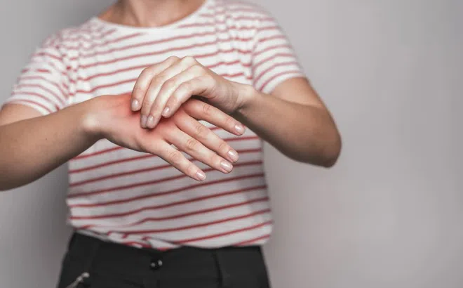 Thời điểm bệnh gout dễ khởi phát
