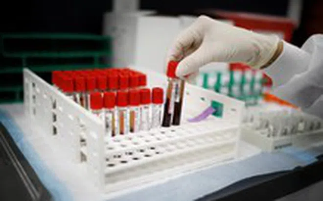 Phát hiện nhóm máu mới, cả thế giới chỉ một người có