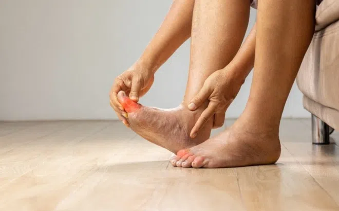 Dấu hiệu ở tay chân cảnh báo axit uric cao