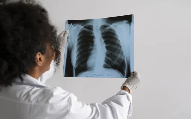 6 lầm tưởng phổ biến ở người mắc bệnh phổi