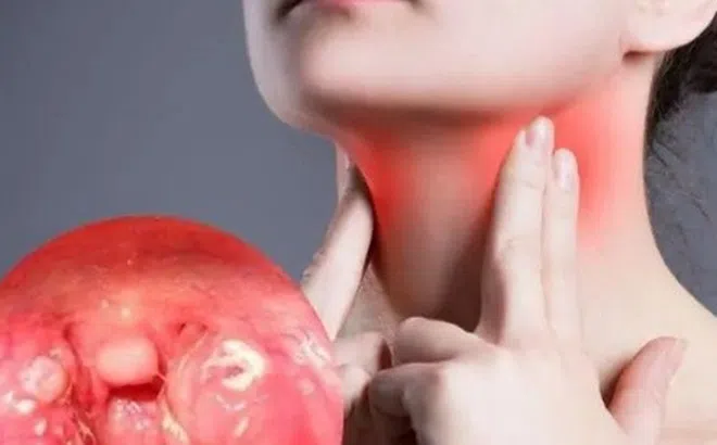 Viêm họng cấp có thể gây ra biến chứng gì?