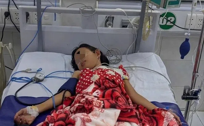 Bé gái 7 tuổi sốc sốt xuất huyết, phải thở máy do nhập viện trễ