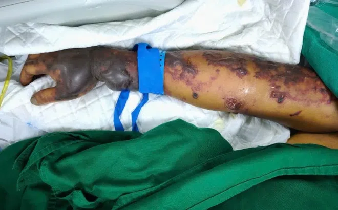 Một căn bệnh gây ám ảnh bác sĩ