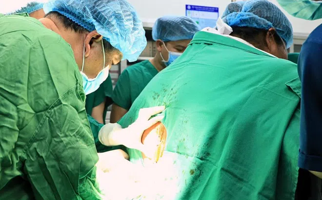 Ca mổ lấy thai hy hữu, không thể gây tê tủy sống cho sản phụ nặng 178kg